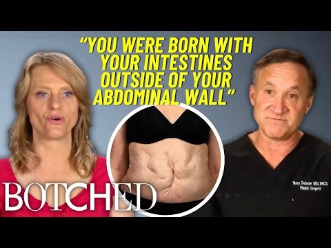 Sandra Was Born With Her Intestines OUTSIDE of Her Body?! *FULL TRANSFORMATION* | Botched | E!