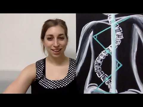 Understanding scoliosis x-rays: Cobb angle