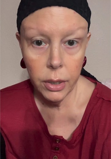 Adrenal Crisis: Sharing My Journey with Addison's Disease