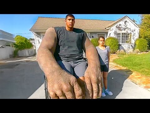 10 Humans With Extremely Rare and Gigantic Physical Features