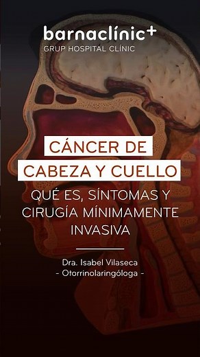 CÁNCER DE CABEZA Y CUELLO: Qué es, síntomas y cirugía mínimamente invasiva | Dra. Isabel Vilaseca