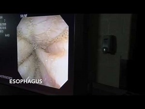 Gastroscope of Equine Stomach