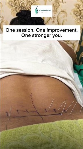 Healing in Motion | Physiotherapy Recovery Journey Explained