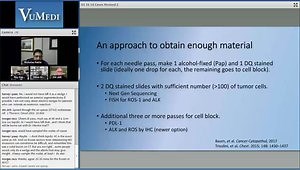 Diagnosis and EBUS Staging of a Lung Cancer