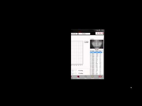 Diagnosys Dark Adaptometry