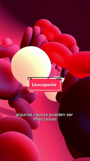 ✍️ La leucopenia no es una enfermedad como tal, sino que es causada por otras enfermedades. En este video te explico a detalle de que se trata. 📲Agenda tu cita al 9993952143 📍Consultorio 201 Eme Red, Calle 33 #496 entre 56 y 56A Mérida Yucatán. #leucopenia #hematólogo #linfocitos #leucocitos #globulosblancos #globulosrojos