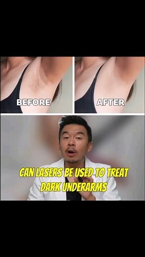 15K views · 25 reactions | Can laser treatment be used to treat...