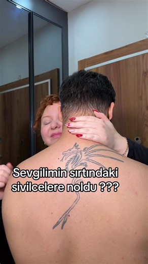 Effective Solutions for Treating Acne on the Back