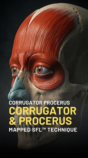 503K views · 3.1K reactions | 廊 Those frown lines between your brows...