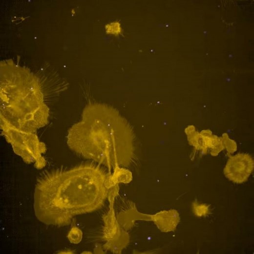 Hungry, Hungry Macrophages