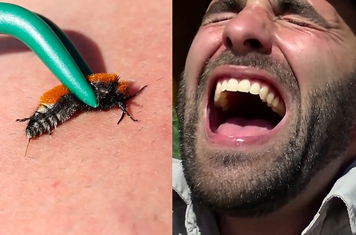 Man purposely lets one of nature's scariest bugs sting him