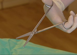 Dammschnitt  wird bei Geburten zu oft geschnitten?