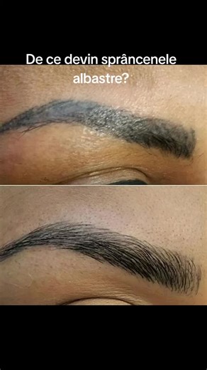 Why Do Eyebrows Turn Blue?