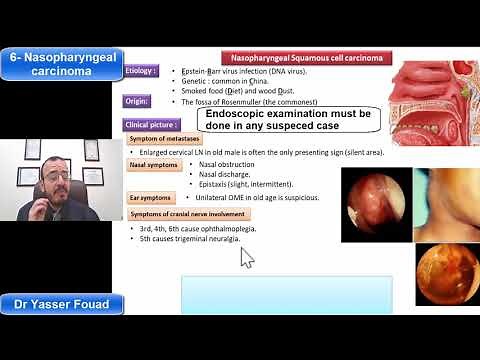 6- Nasopharyngeal Carcinoma