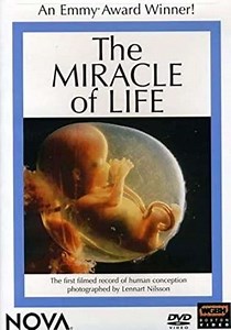 The Miracle of Life (1983) - Movie