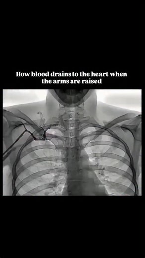 World of Biology on Instagram: "“Ever wondered what happens to your blood flow when you raise your arms?” When you lift your arms, gravity actually helps blood return from the upper limbs back to your heart more easily. The veins in your arms are equipped with one-way valves that keep the blood moving in the right direction, preventing any backward flow. This process is also supported by muscle contractions and the pumping action of the heart, working together to keep your circulation smooth and