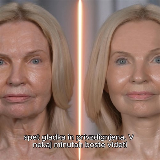 Časovno omejena ponudba! ⏰ 😍 Ustavite čas na svoji koži – z Velform Renew! Vaša koža si zasluži le najboljše. Če se borite z gubami, utrujenim videzom ali izgubo čvrstosti – to je rešitev, na katero ste čakali! Napreden kolagenski serum, ki: ✅ Intenzivno vlaži in gladi kožo ✅ Zmanjšuje videz gub in znakov staranja ✅ Obnavlja elastičnost in sijaj ✅ Se hitro vpije – brez mastnega občutka ✅ Vsebuje naravne sestavine, prijazne do vaše kože 🔥 Tisoče zadovoljnih uporabnic že prisega nanj – pridružit