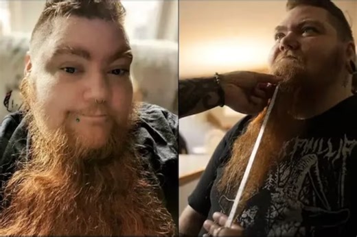 US Woman Grows Guinness World Record-Breaking Beard
