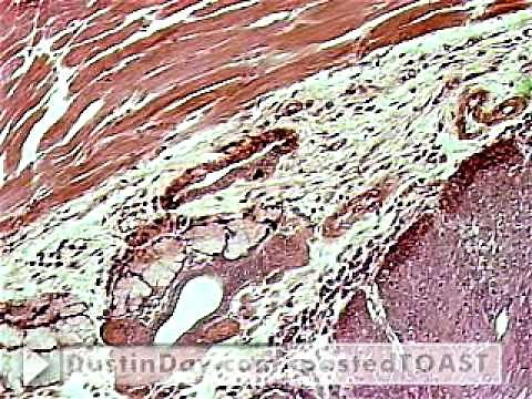 Skeletal muscle under microscope