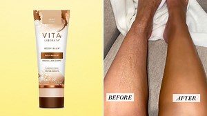 Vita Liberata's Body Blur Makes My Scars Disappear