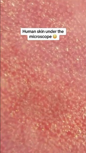 Human Skin Under The Microscope ….#Microscope
