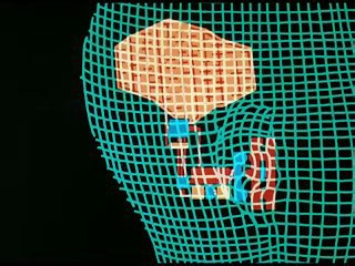 La Femme bionique | show | 1976 | Official Trailer