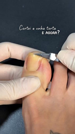 Tatiane Lima | Unhas Naturais on Instagram: "Já aconteceu com você? Usei o esmalte patins que é PERFEITO 🥰 🛍️ você encontra ele no @mercadolivre , é só colar o código no buscador do app Patins: TAILI1-EG4A #MeusFavsDoMercadoLivre #MercadoLivre #footnails #footnail #unhadospés"