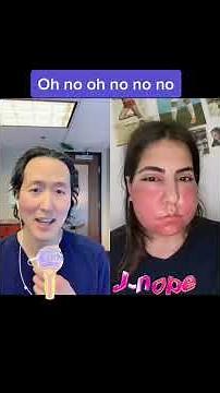 Massive Allergic Reaction?!?! #shorts #allergicreaction