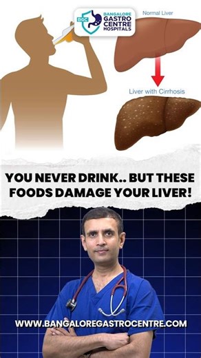 You Never Drink ! But THESE Foods Are Damaging Your Liver!