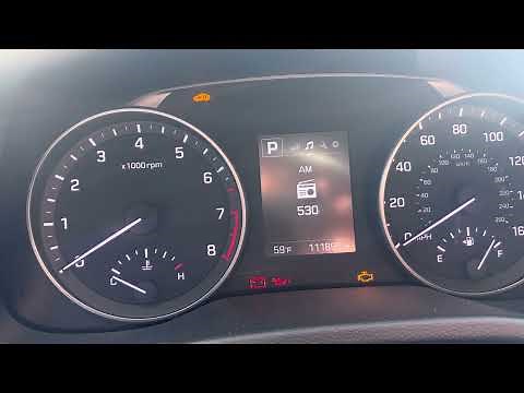 Hyundai Elantra 2017 2.0L Oil Light Reset Procedure (Step-by Step) (Guide)