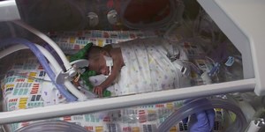 'Octopus' helps calm premature babies in NICU