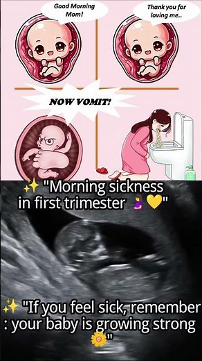 ✨ "Morning sickness in first trimester 🤰💛"With 12 weeks fetus #baby #ultrasound