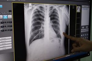 How Meth Use Affects Your Lungs - Desert Cove Recovery