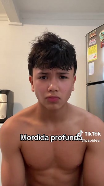 Understanding Deep Bite: Effects on Facial Harmony