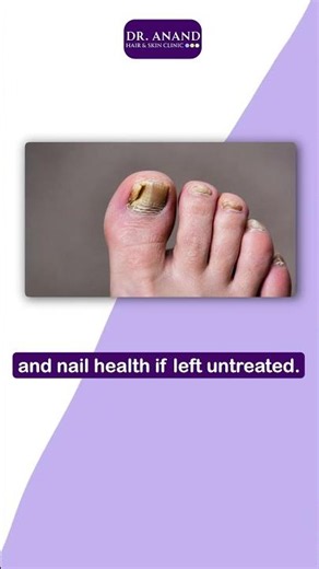 How to Get Strong, Healthy-Looking Nails Again | Dr Anand