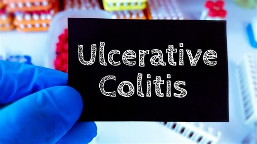 Managing Ulcerative Colitis Pain: Expert Lists Ways To Find Relief During Flares