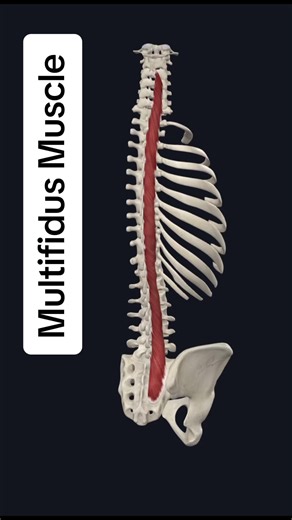 Origin: Posterior superior iliac spine, dorsal surface of sacrum, mammillary processes of lumbar vertebrae, transverse processes of thoracic vertebrae, articular processes of C4-C7 vertebrae. Insertion: Spinous processes of lumbar, thoracic, and cervical vertebrae. Action: Extends neck and trunk; stabilizes vertebral column. Innervation: Medial branches of posterior rami of cervical, thoracic, and lumbar nerves. The multifidus is a major pain generator of the spine and pelvis due to its insertio