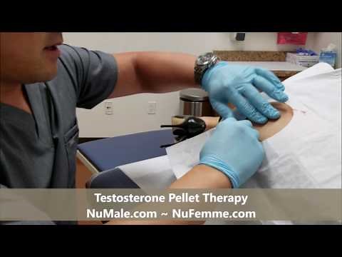 Testosterone Pellet Therapy ~ Dr. Christopher Asandra