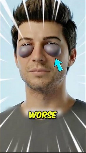 The Real Reason You Get Bags Under Your Eyes