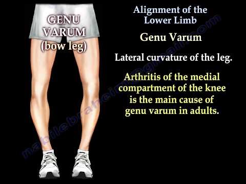 Alignment Of The Lower Limb - Everything You Need To Know - Dr. Nabil Ebraheim