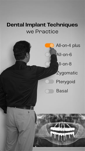 Revolutionizing smiles for over 30 years! At FMS Dental, we specialize in advanced dental implant techniques, restoring confidence one smile at a time. From immediate loading implants to zygomatic implants, our expertise ensures precision, comfort & long-lasting results. our journey in transforming lives! #DentalImplants #FMSDental #SmileTransformation #ImplantExperts #30YearsOfExcellence | FMS International Dental Center