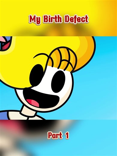 My Birth Defect - Part 1 #usa🇺🇸 #fypシ゚viral #animation #viralvideo #viralvideo