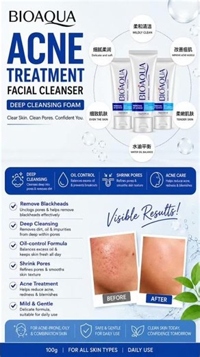 BioAqua Acne Cleanser