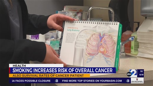 Lung cancer risk: 'In smokers is 15 to 30 times what it is non-smokers'