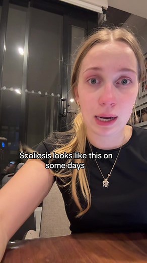 this is the reality of it #fyp #foryou #scoliosis #scoliosisawareness | scoliosis