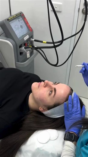 Skin changes with time. Laser Rejuvenation helps you take it back. ✨ Tighter pores ✨ Smoother texture ✨ Fresher glow All with zero downtime. Book your free consultation now | Australian Skin Clinics