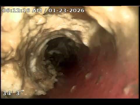 Sewer Lateral Inspection