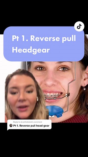 Exploring Reverse Pull Headgear in Orthodontics