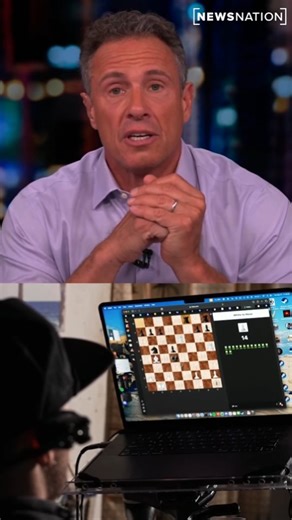 4K views · 182 reactions | Neuralink Brain to Computer Interface ... . . . . #neuralink #braincip #elonmusk | Tech Overwatch | Facebook