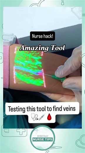 Testing the Vein Finder: Does it Work? 🤔